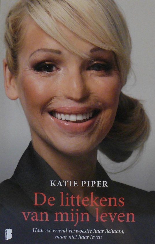 De littekens van mijn leven / druk Heruitgave - Katie Piper