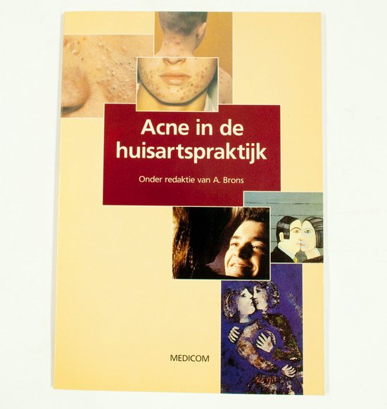 Acne in de huisartspraktijk - A Brons